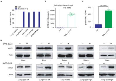 Folic acid restricts SARS-CoV-2 invasion by methylating ACE2